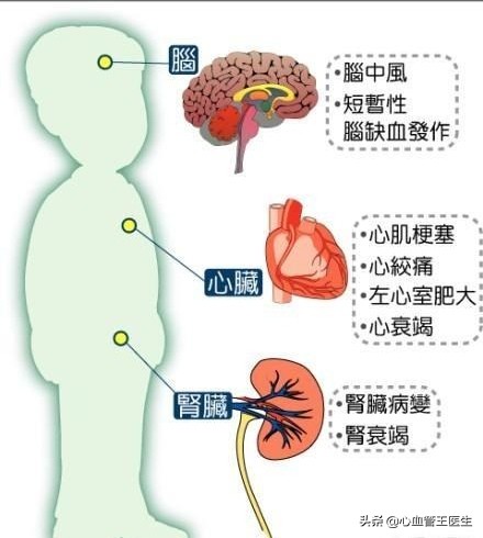 剑灵气功师武器在哪里打孔