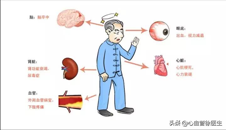 剑灵气功师武器在哪里打孔